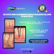 Exito en cobertura radicular parte 2 $USD